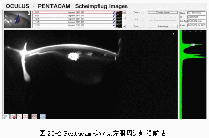 ZY016_119_2.gif